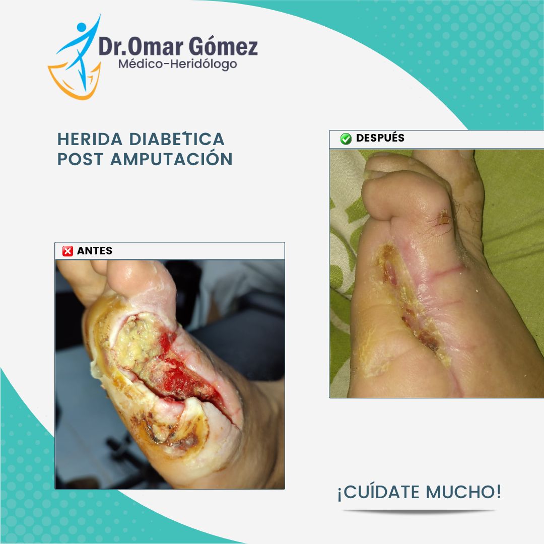 Omar Gómez López-8