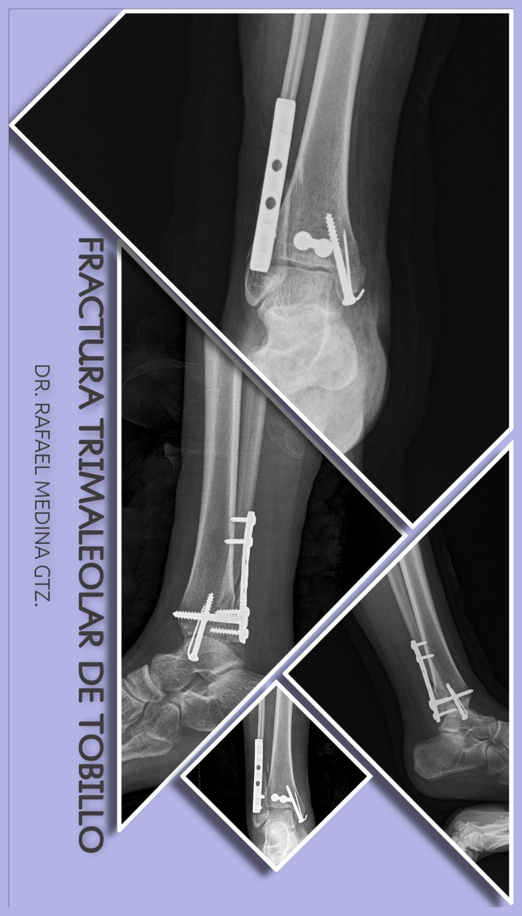 Rafael Medina Gutiérrez-3