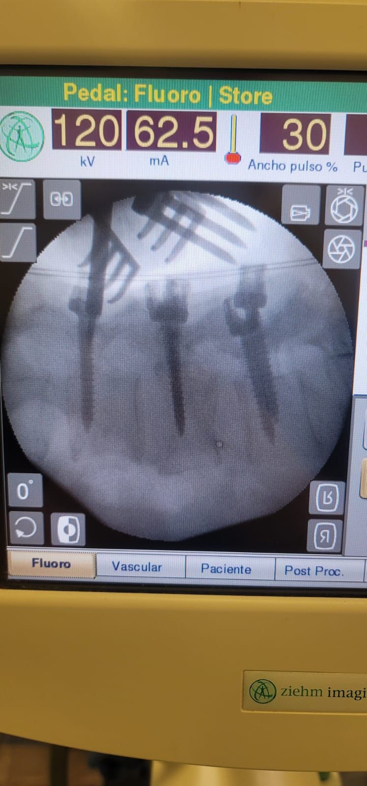 Luis Arnulfo Pérez García-3