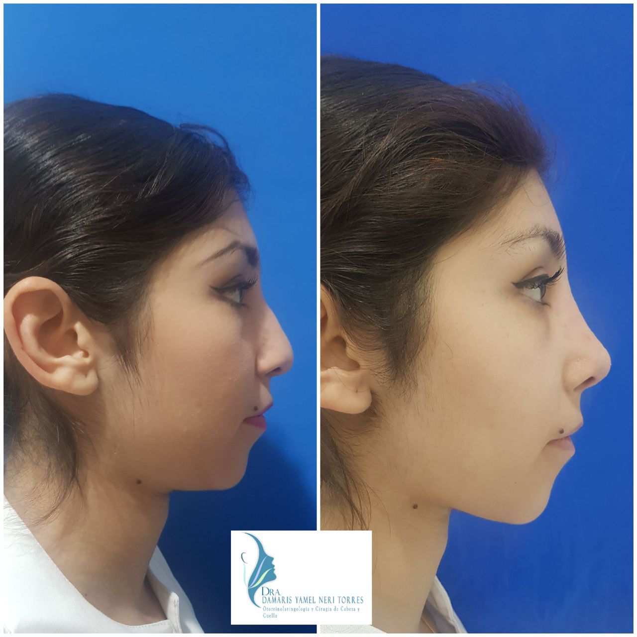 Damaris Yamel Neri Torres-8