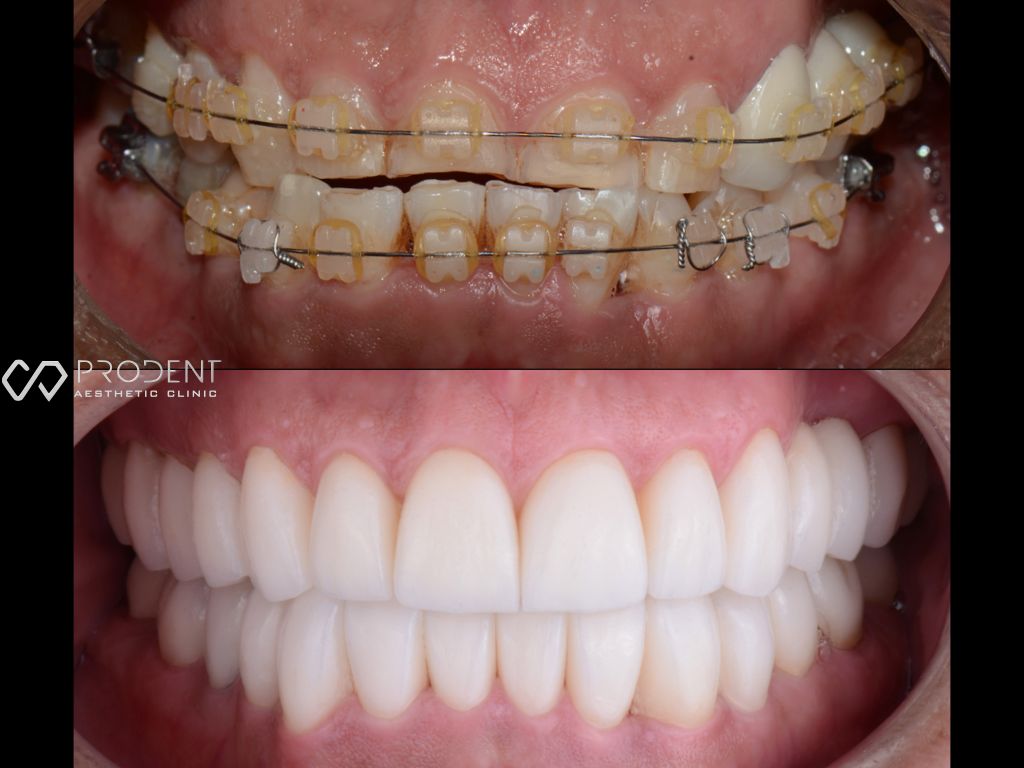 Ulises Pérez Murillo-65