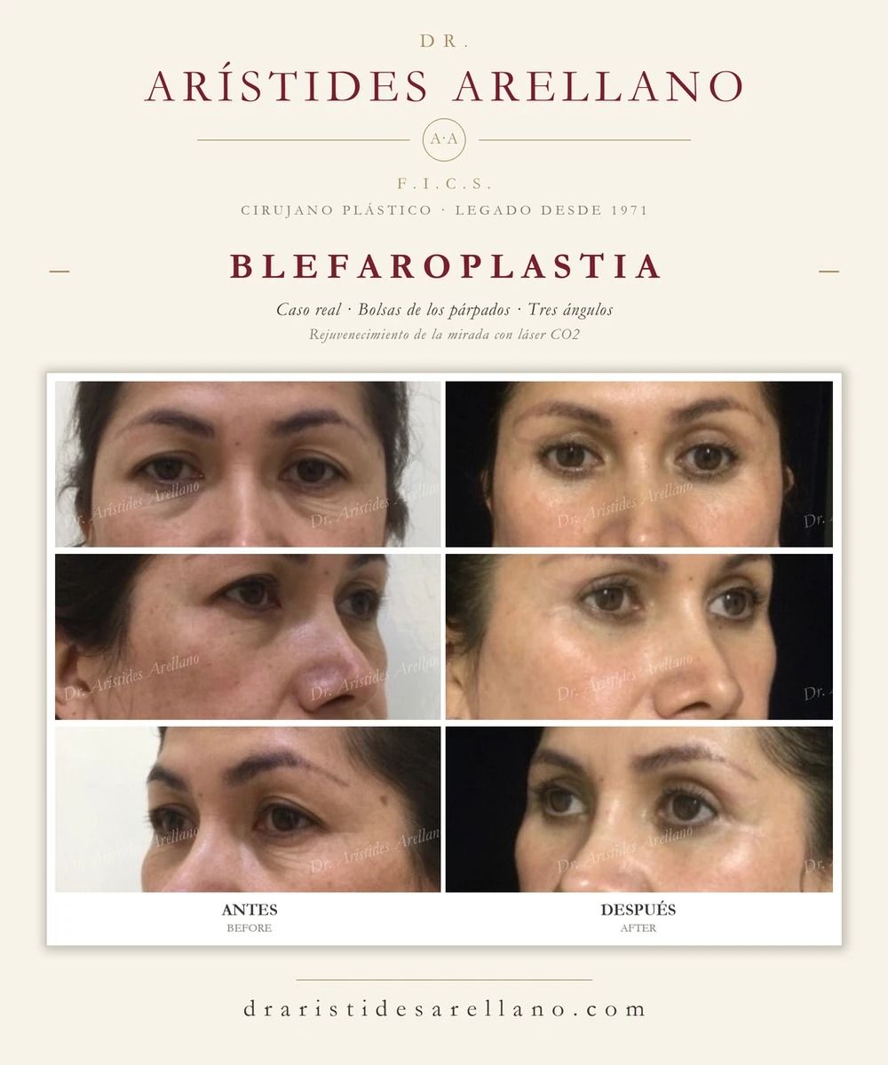 Arístides Arellano Huacuja-6