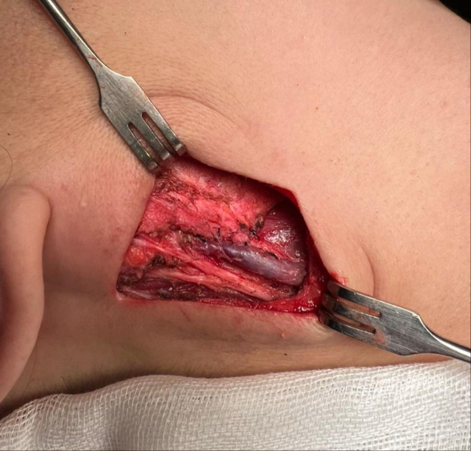 Jose Abraham Sauceda Ramirez-0