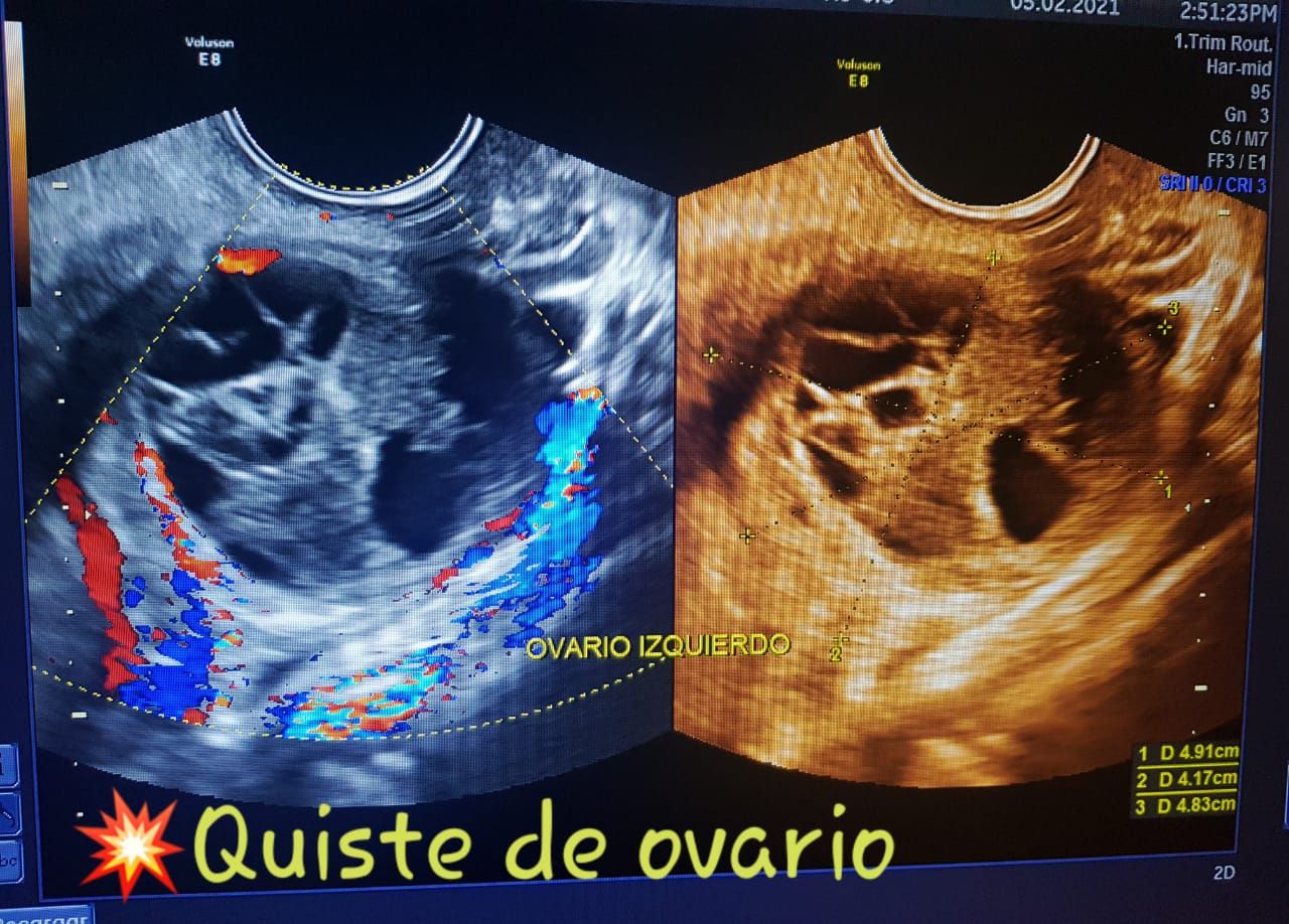 Melina Trujillo Quiroz-45