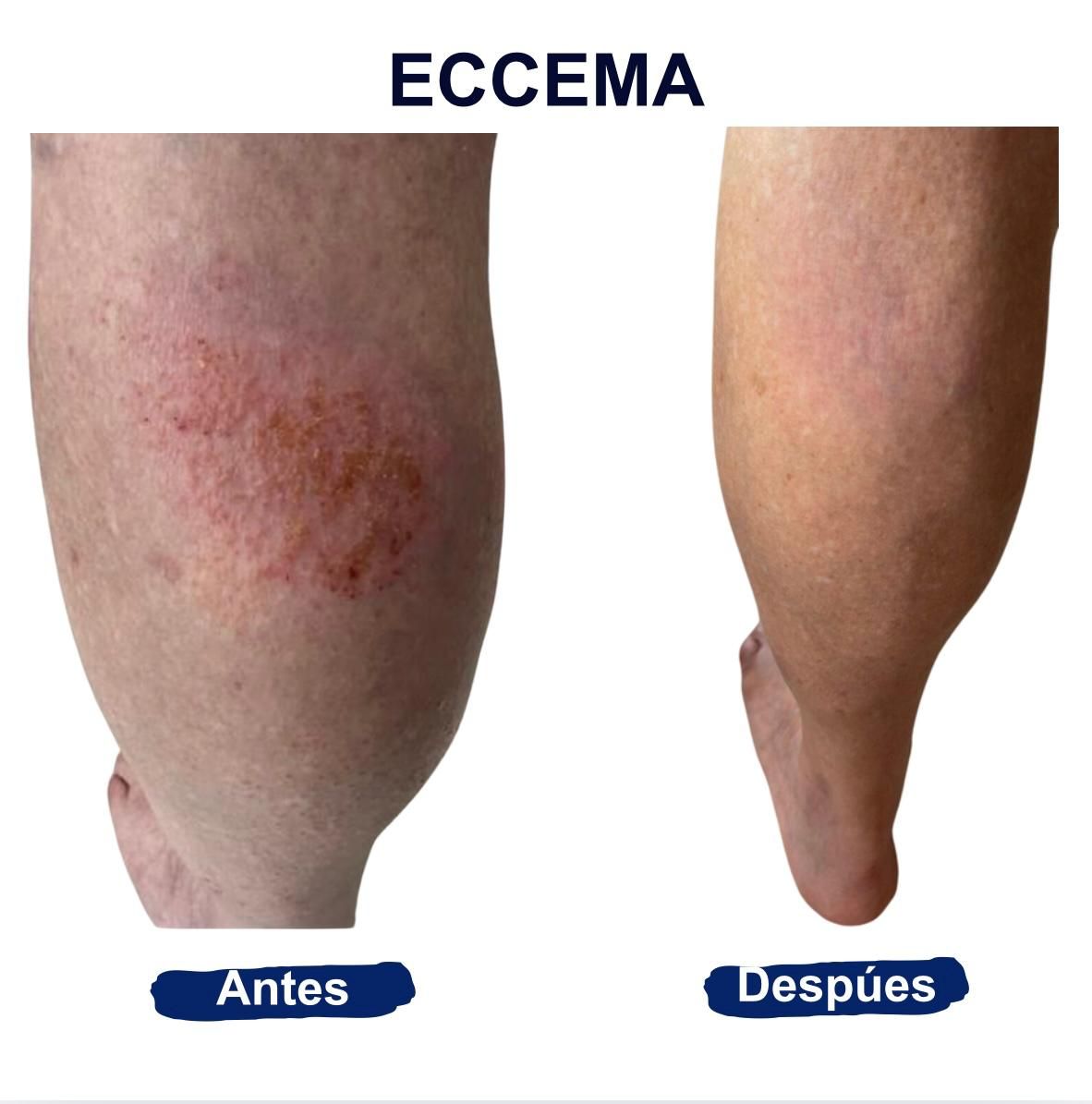 Itzel Anayn Flores Reyes-48