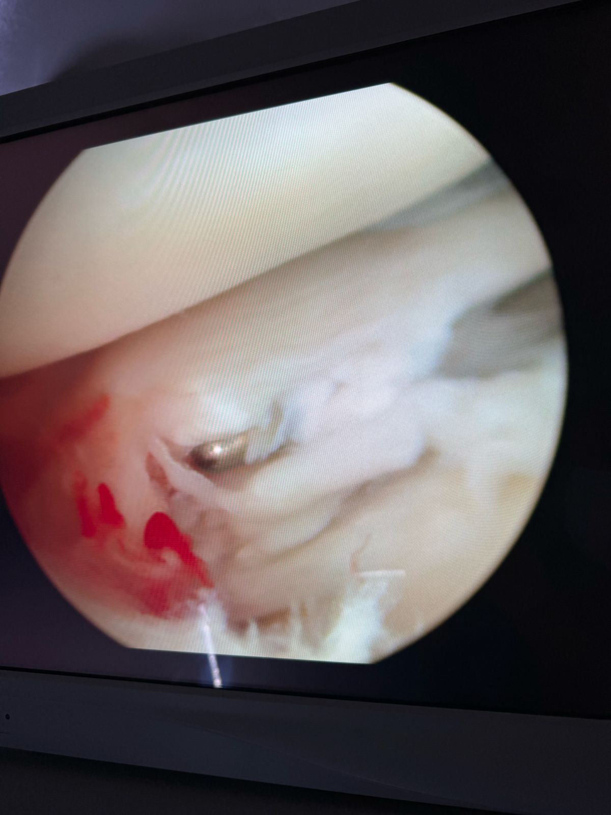 José Enrique Herrera Mesino-5