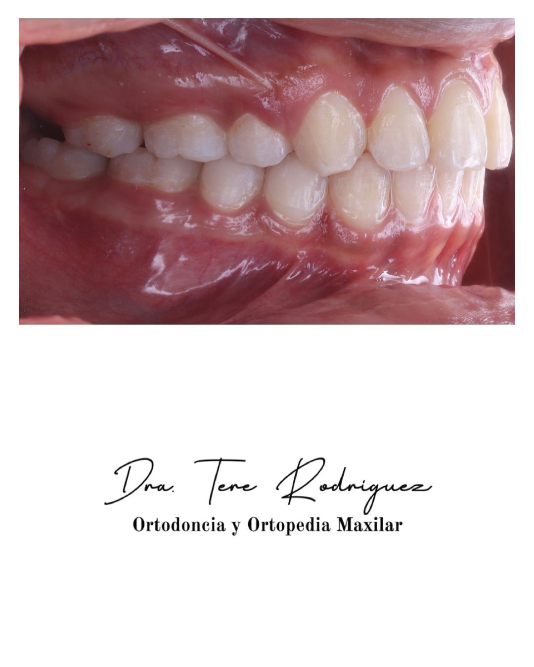 Teresa Rodriguez Candia-0