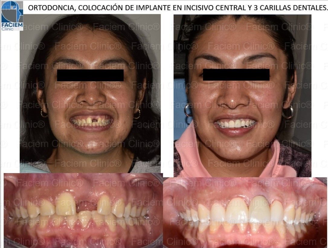 Ricardo Parra García-7