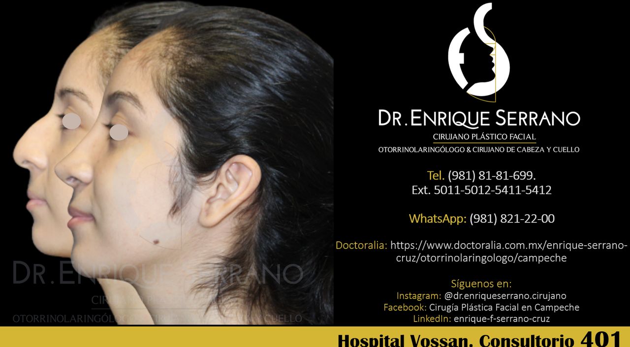 Enrique Serrano Cruz-141