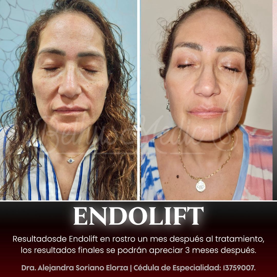 Alejandra Soriano Elorza-66