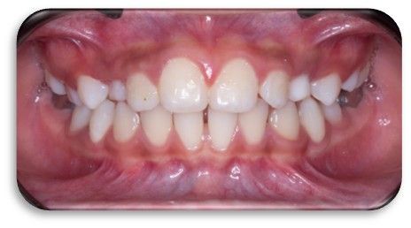 Vicente Emmanuel Silva Rangel-3