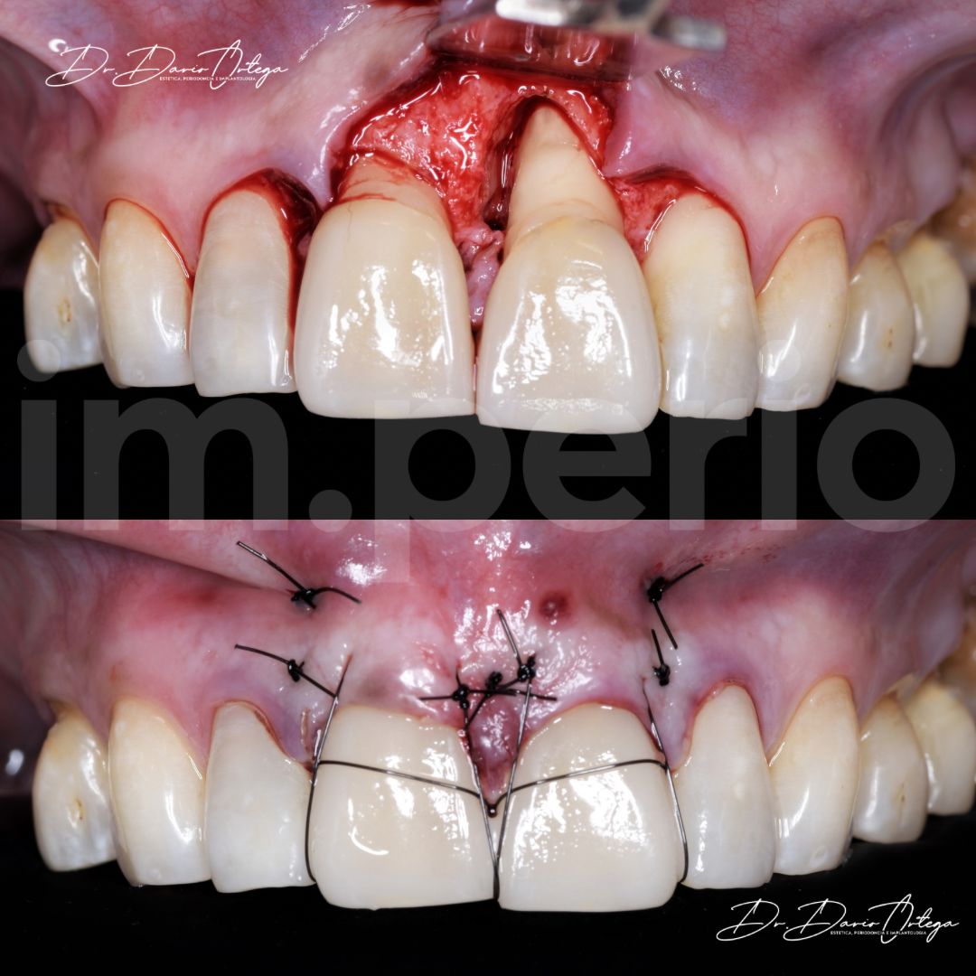 Dario Ortega Aceves-31