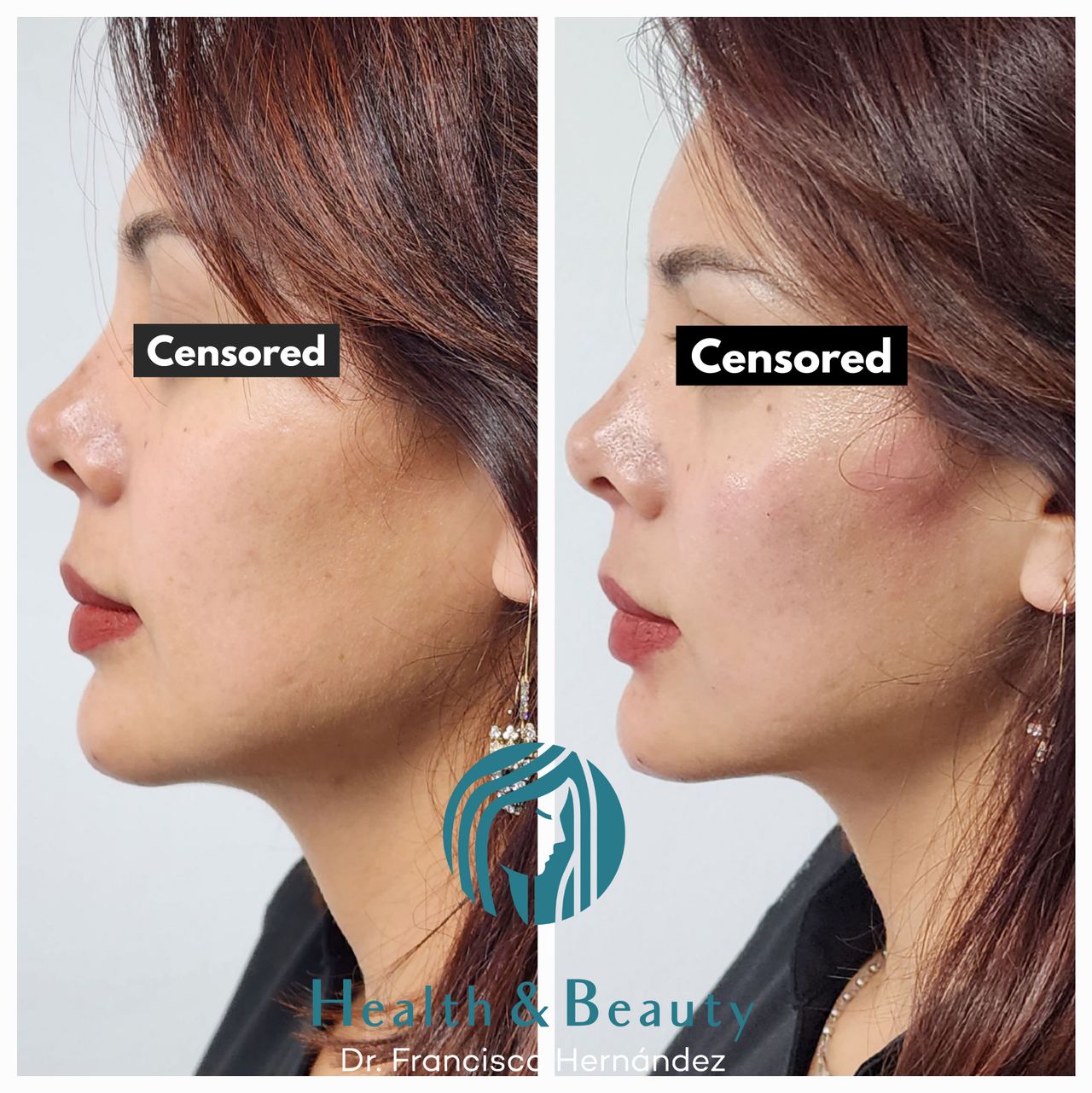 Francisco Hernández Gómez Crespo-44