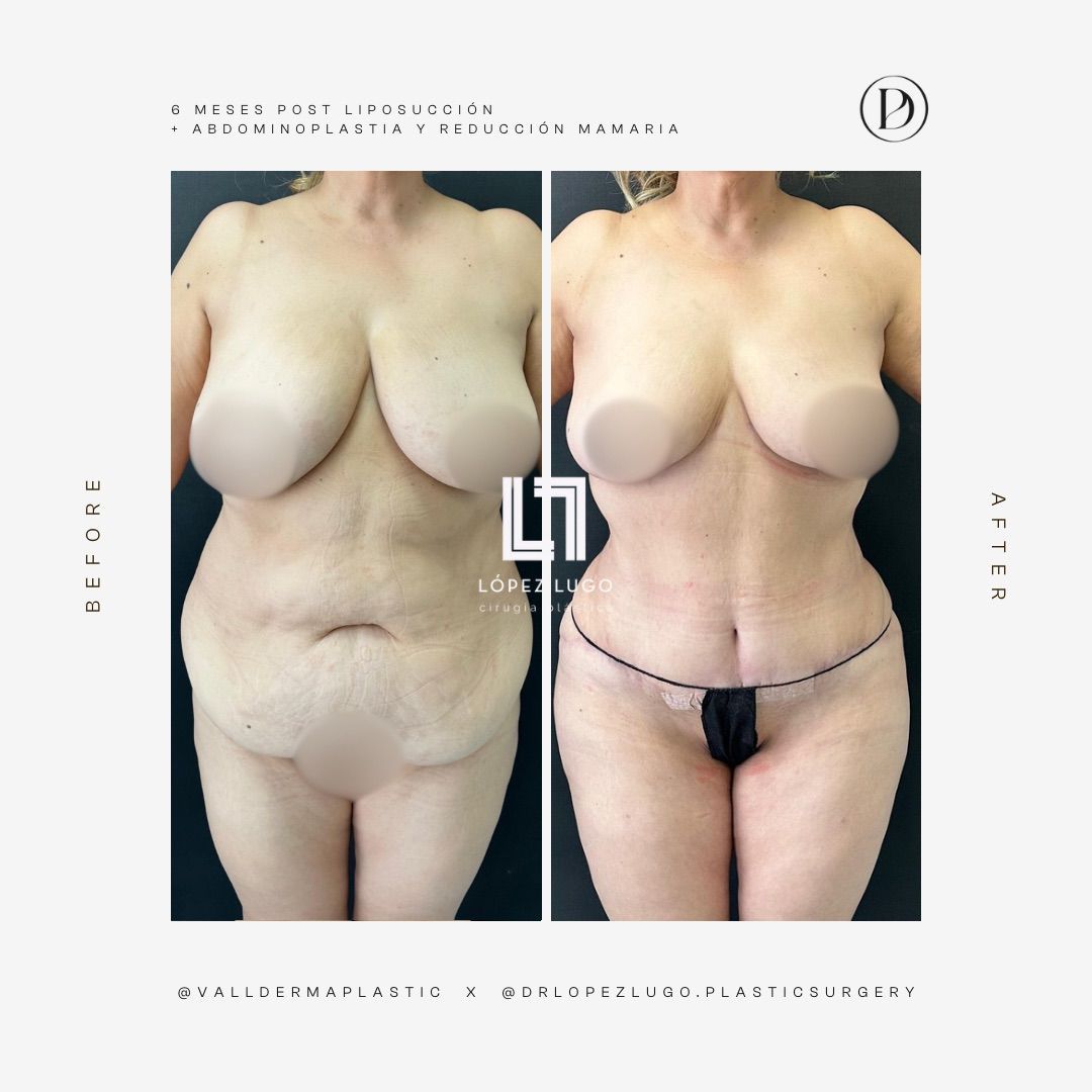 Omar Federico López Lugo-16