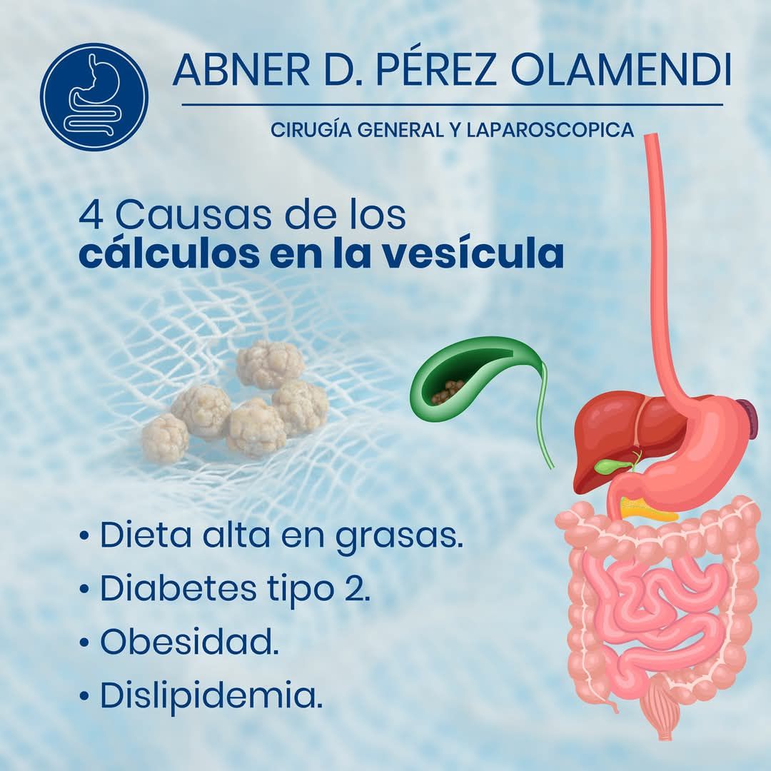 Abner Daniel Pérez Olamendi-20