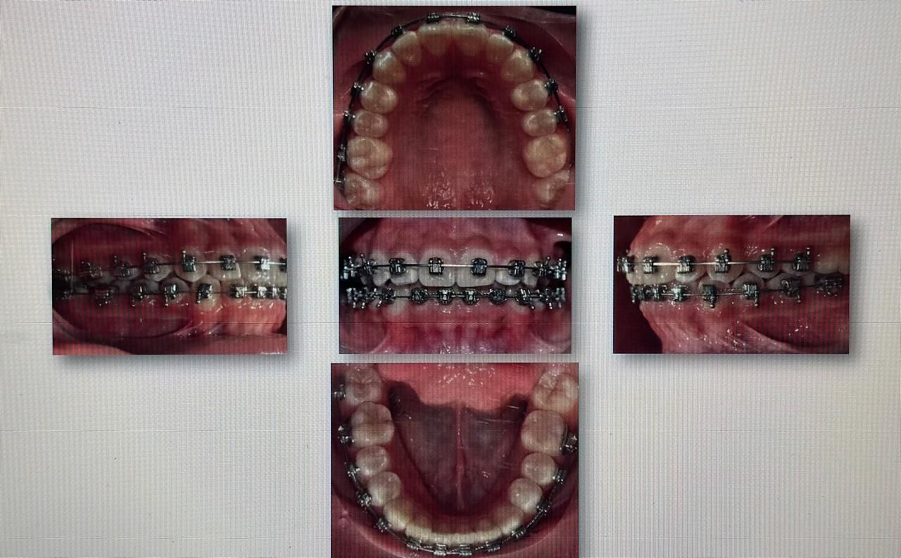 Antonio Gomez Arenas-16