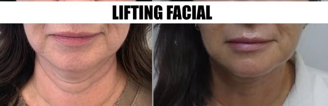 Juan Piña Cazares-61