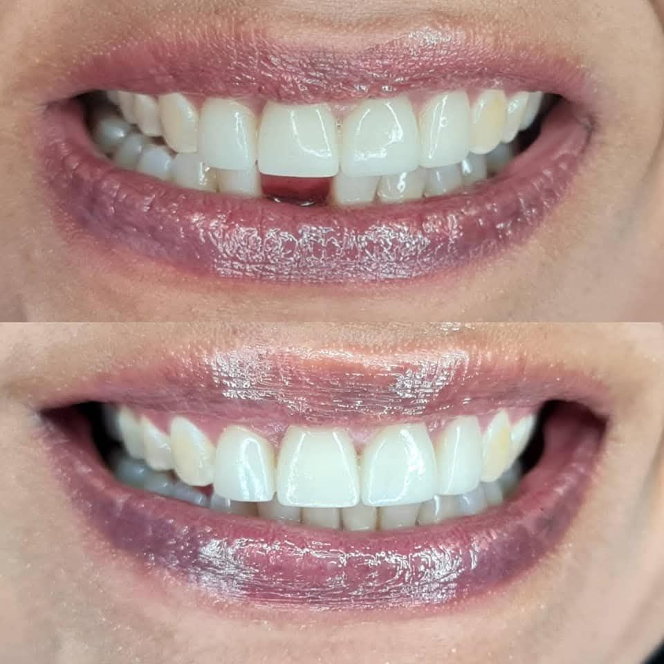 María Rossana Robles Sánchez-13