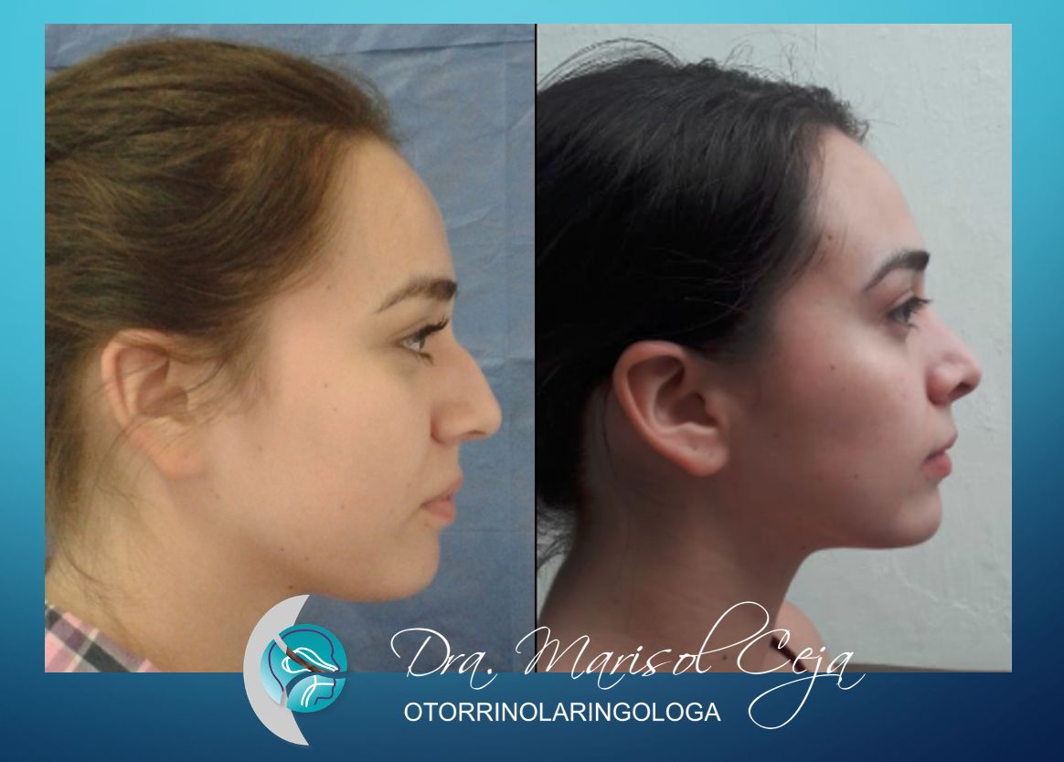 Marisol Ceja Zepeda-14