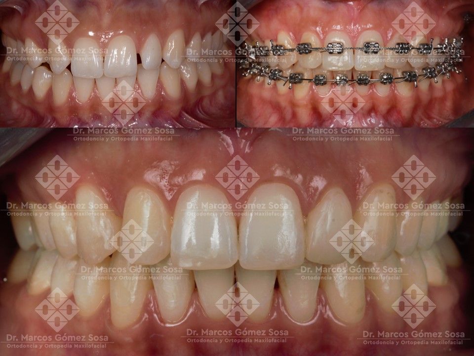 Marcos Gómez Sosa-0