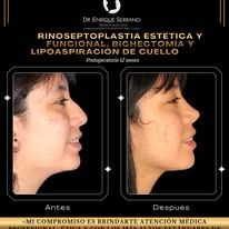 Enrique Serrano Cruz-19