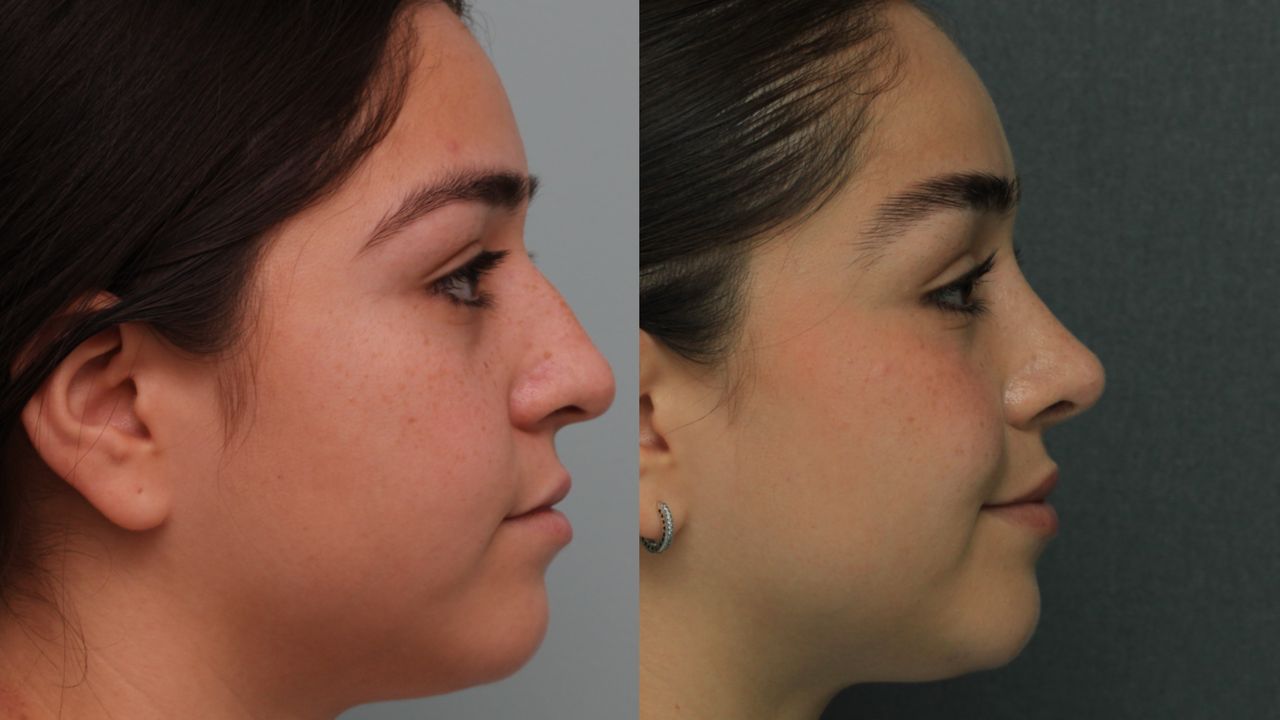 Angel Castro Urquizo-14