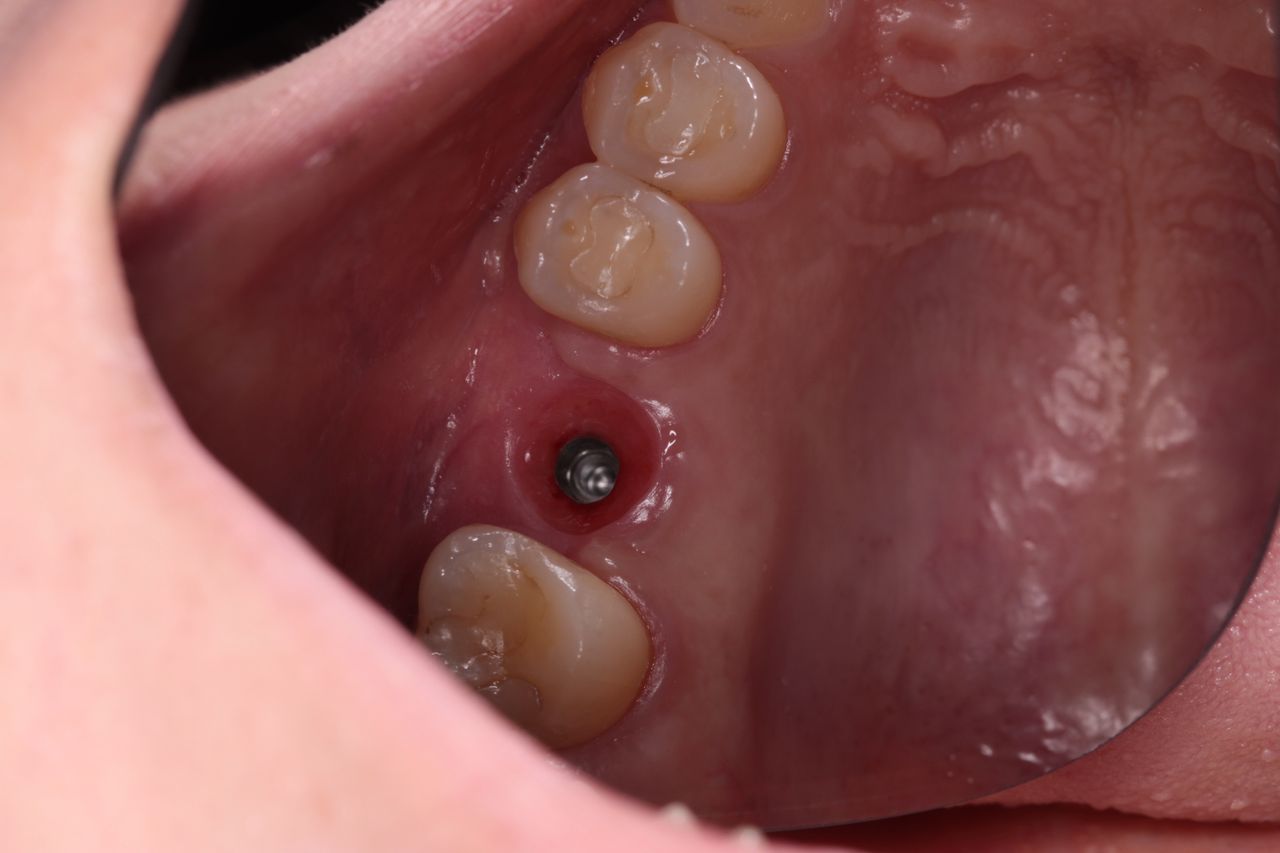 Luis Angel Carranza Resendez-14