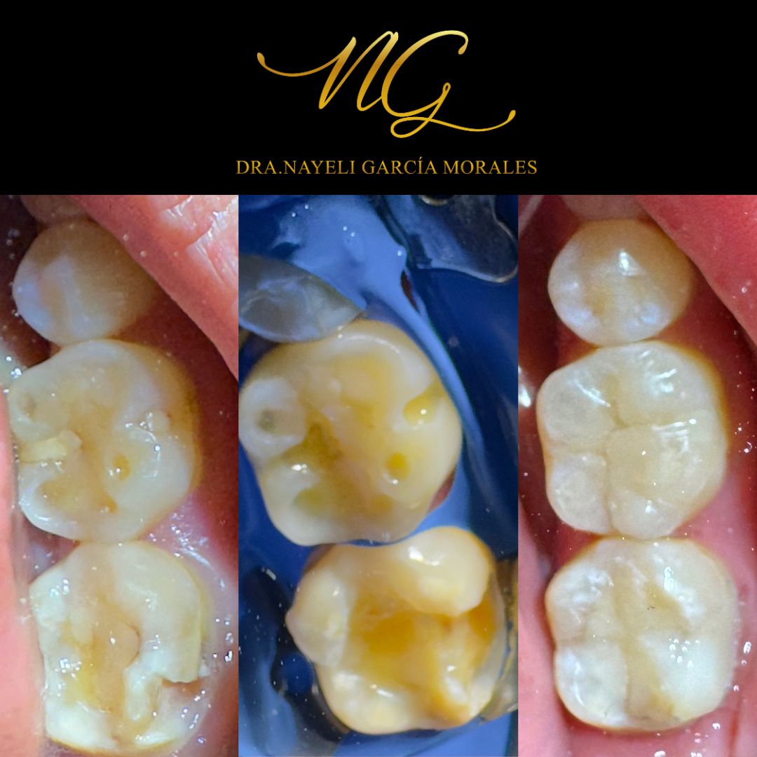 Nayeli Garcia Morales-14