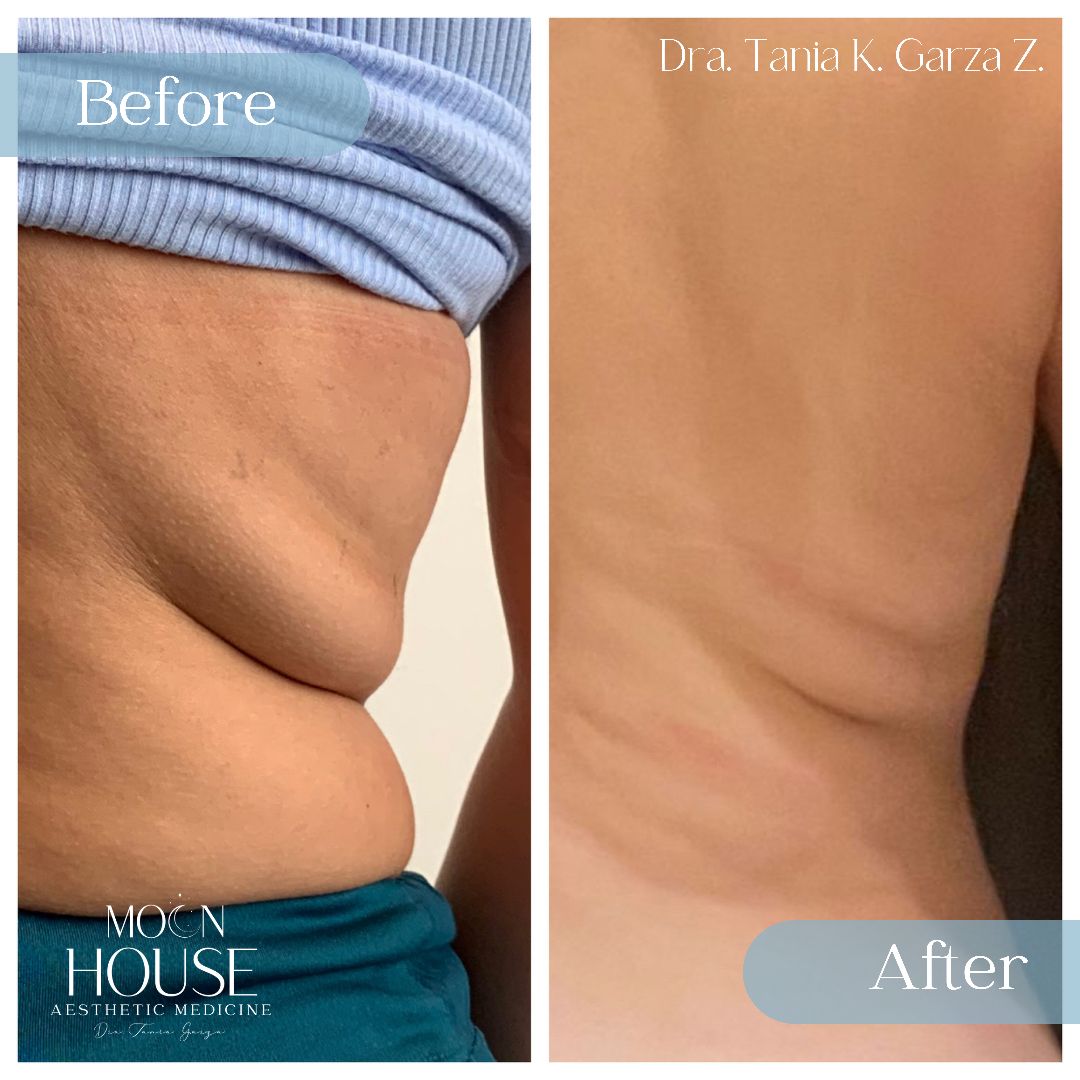 Tania Karine Garza Zepeda-24