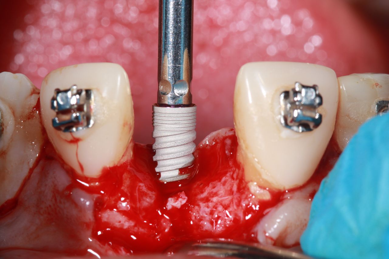 Jesus De La Cruz Ballinas-30