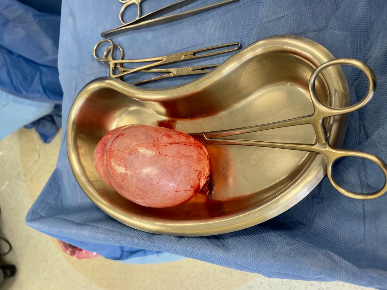 Gonzalo Hernández Martínez-35