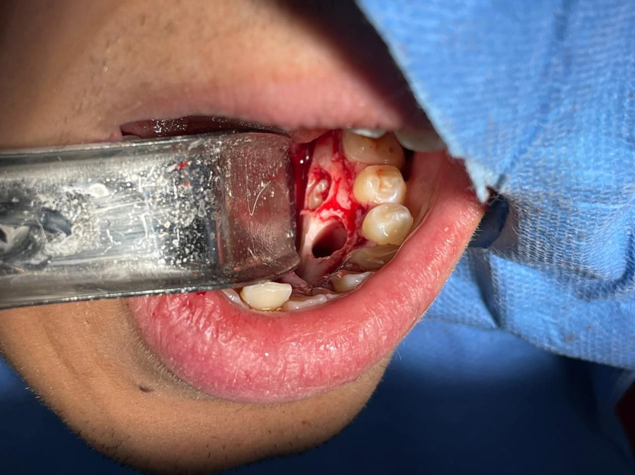 Rodolfo R. Subero Testani-12