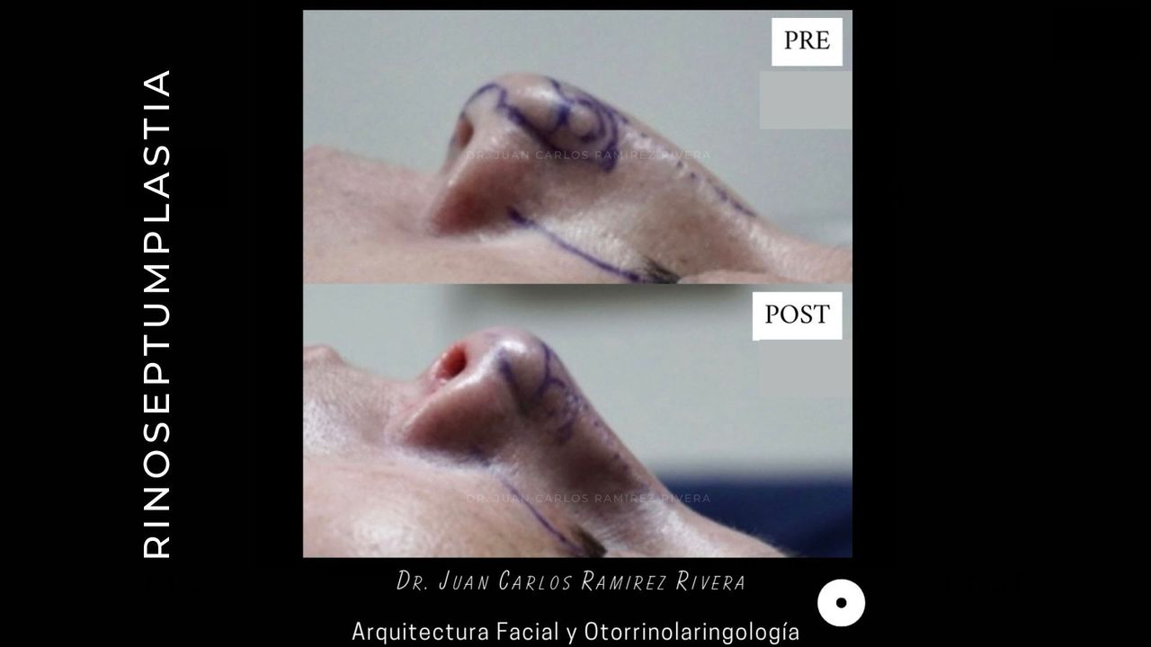 Juan Carlos Ramirez Rivera-8