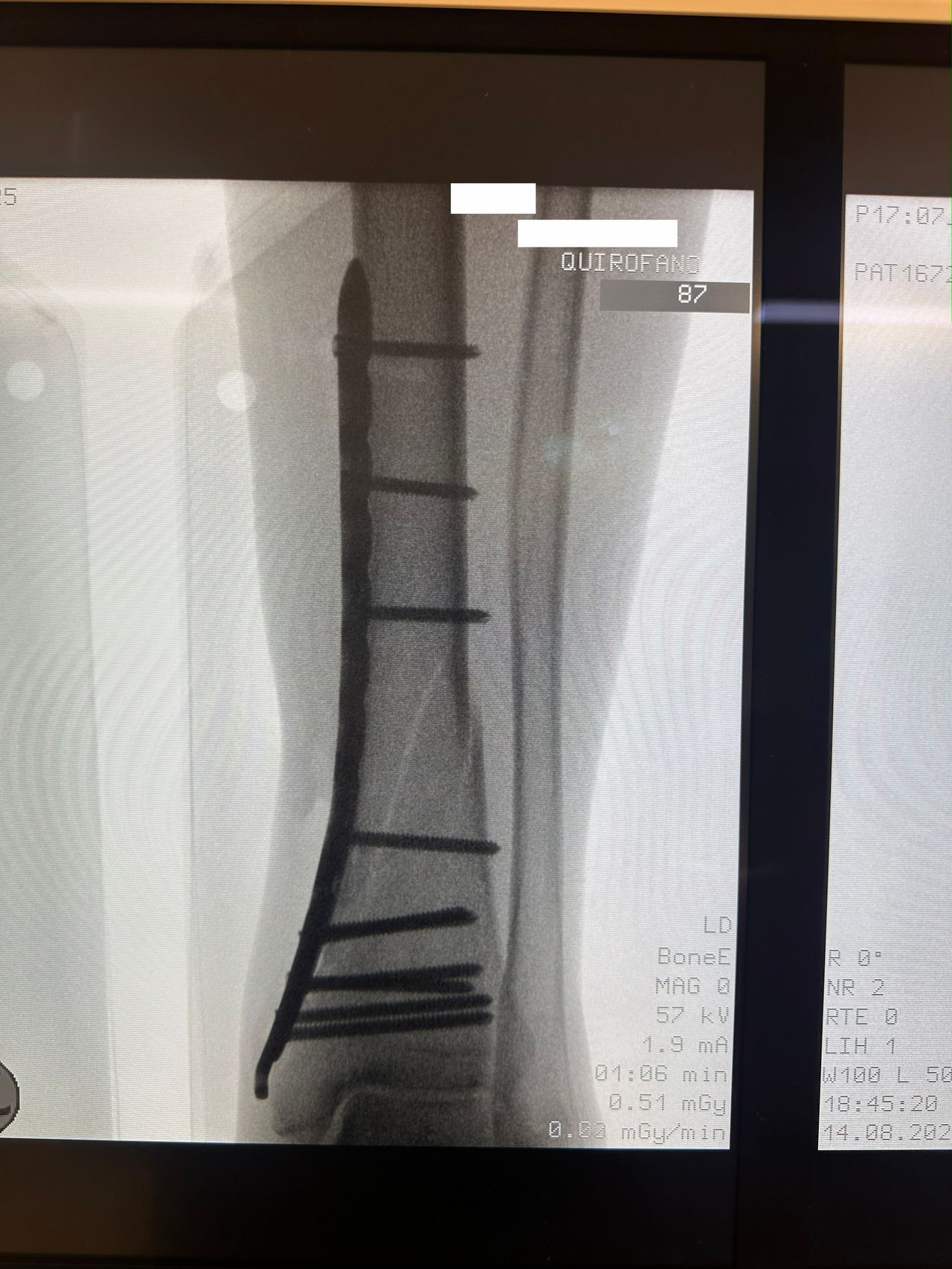 Flabio Ivan Leaños Gutierrez-8