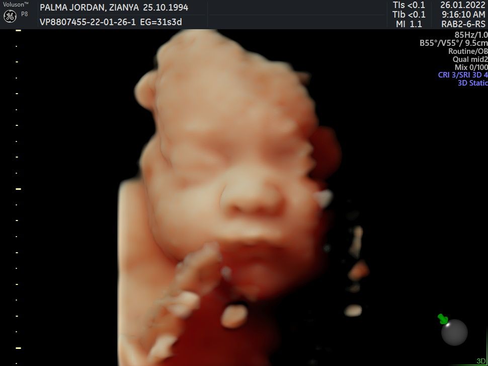 Griselda Reyes Torres-22