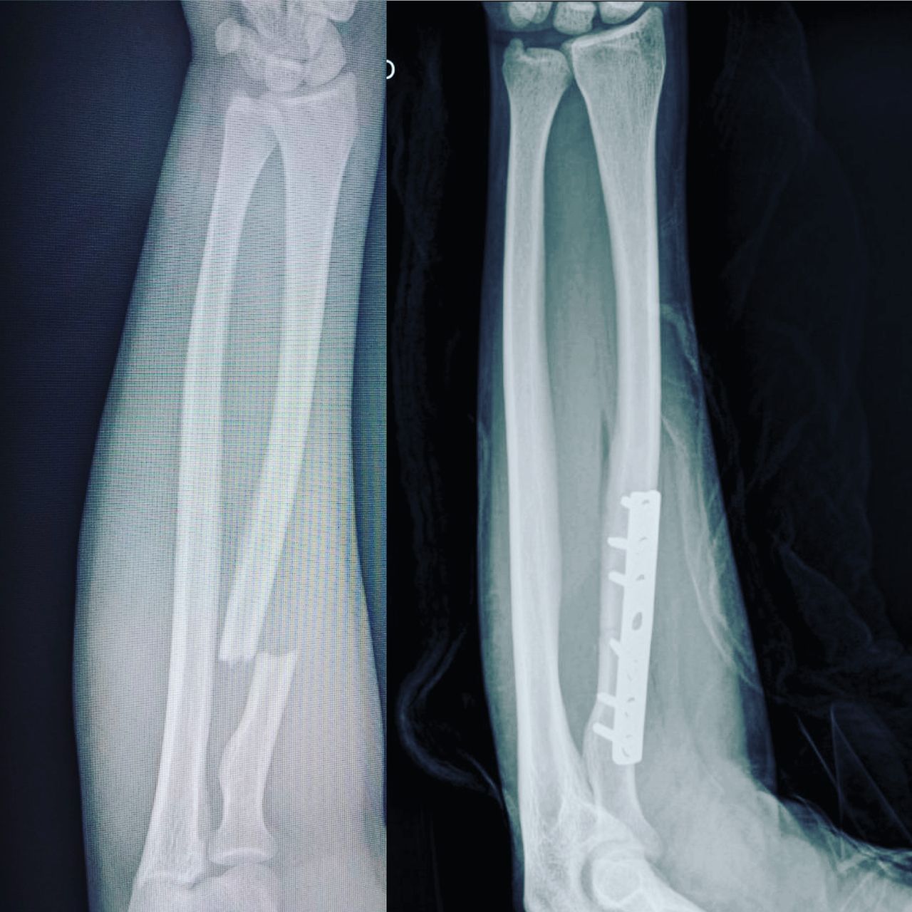 Luis Alberto Monge Bravo-5