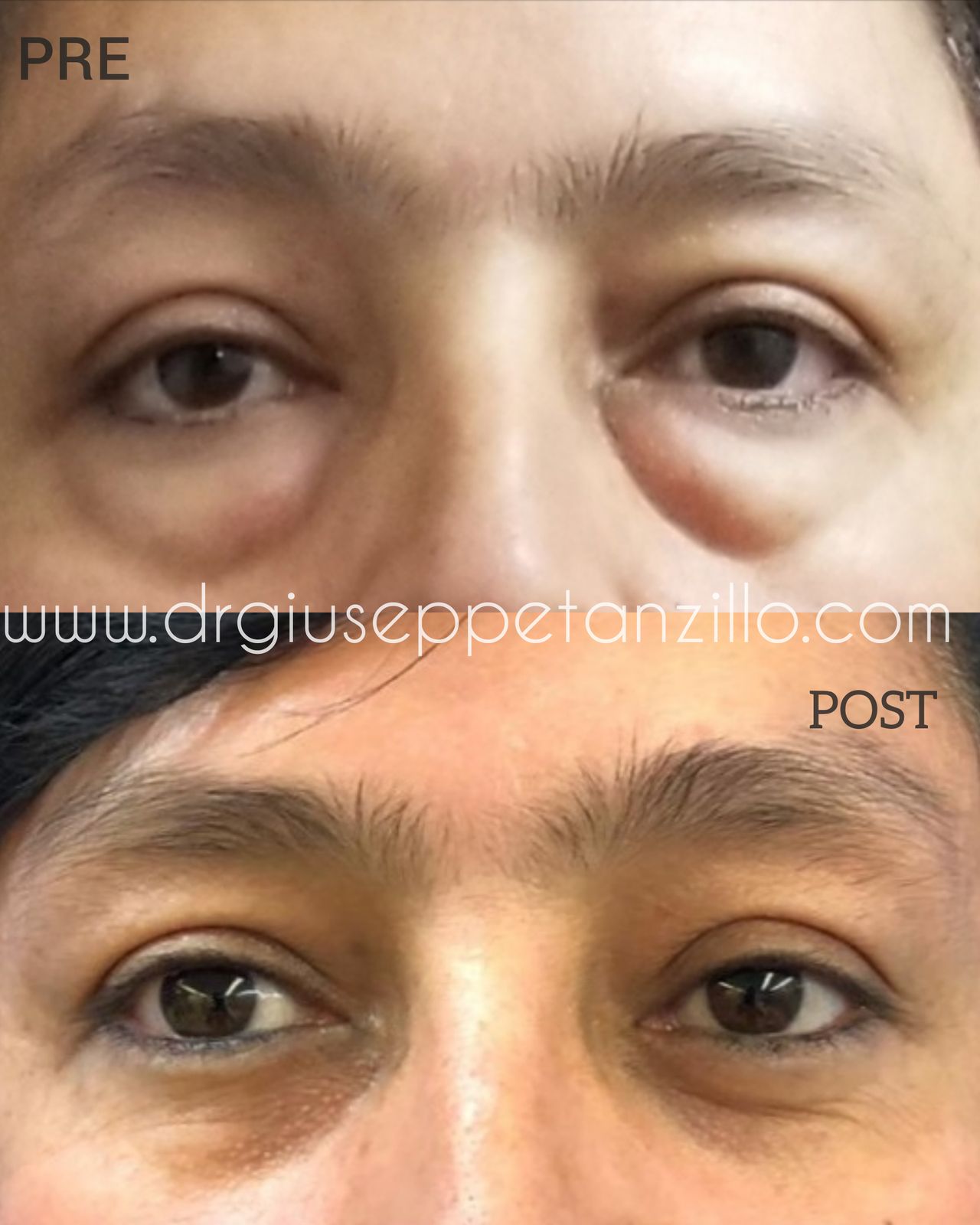 Giuseppe Tanzillo-83