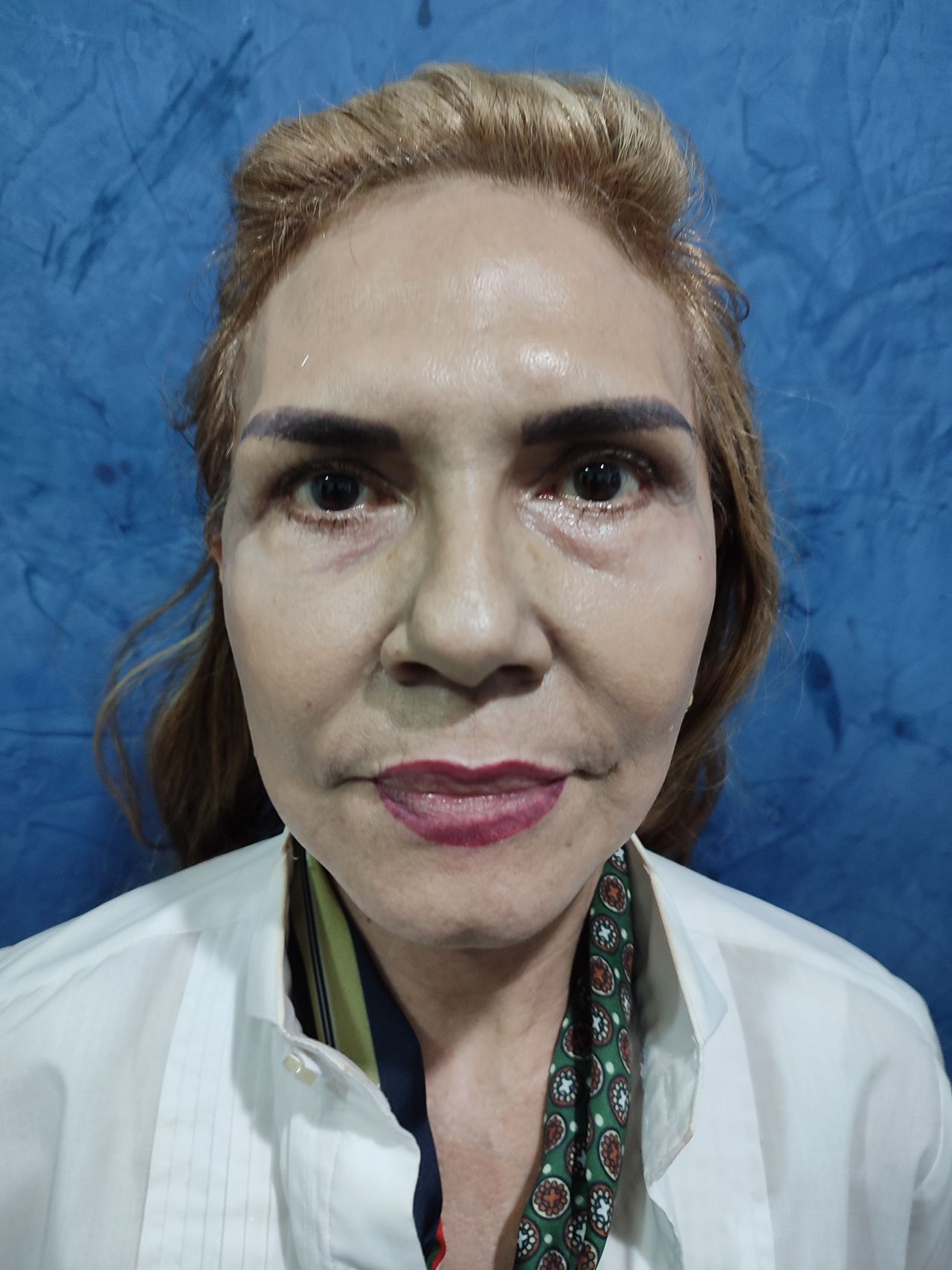 Jacobo Manuel Rotstein Macheleidt-11