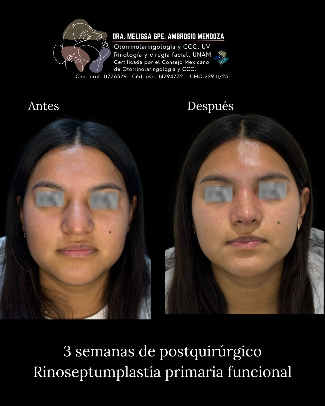 Melissa Guadalupe Ambrosio Mendoza-10