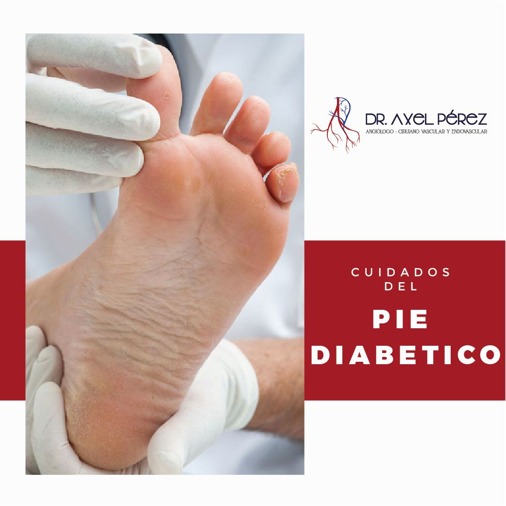 Axel Iván Pérez Flores-0