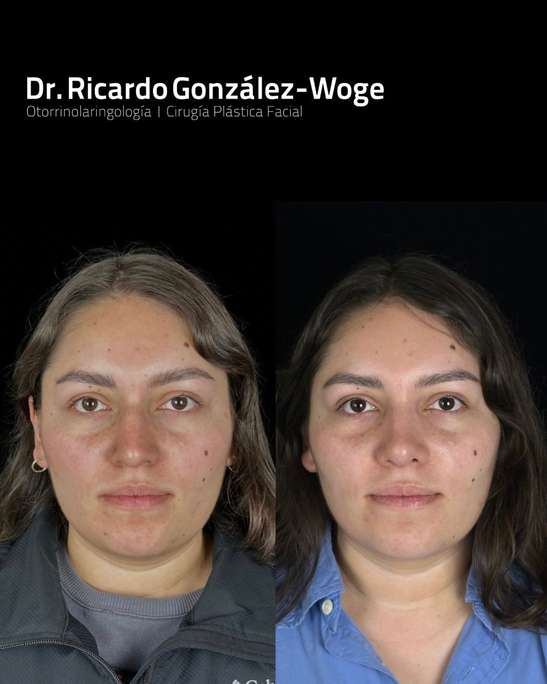 Ricardo Gonzalez Woge-11