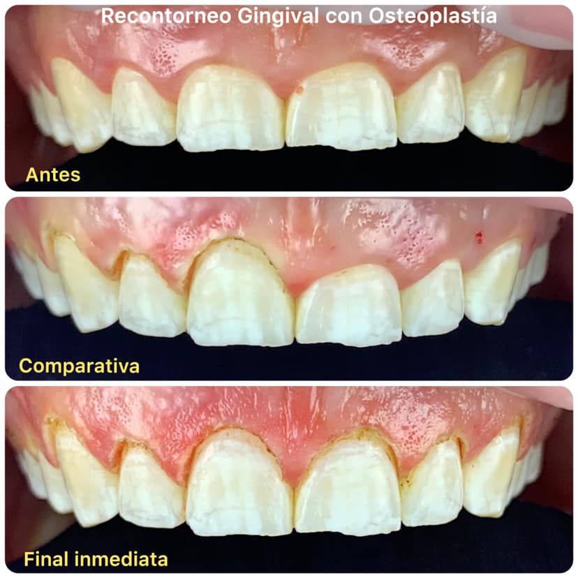 Alejandro Uribe Marioni-0