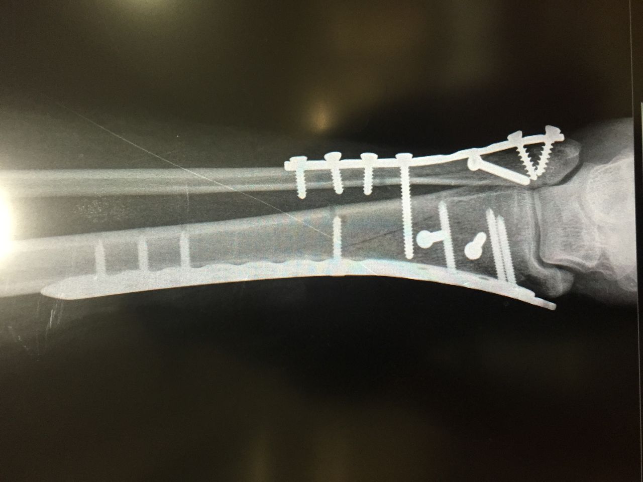 Carlos Alberto Romero Sosa-1