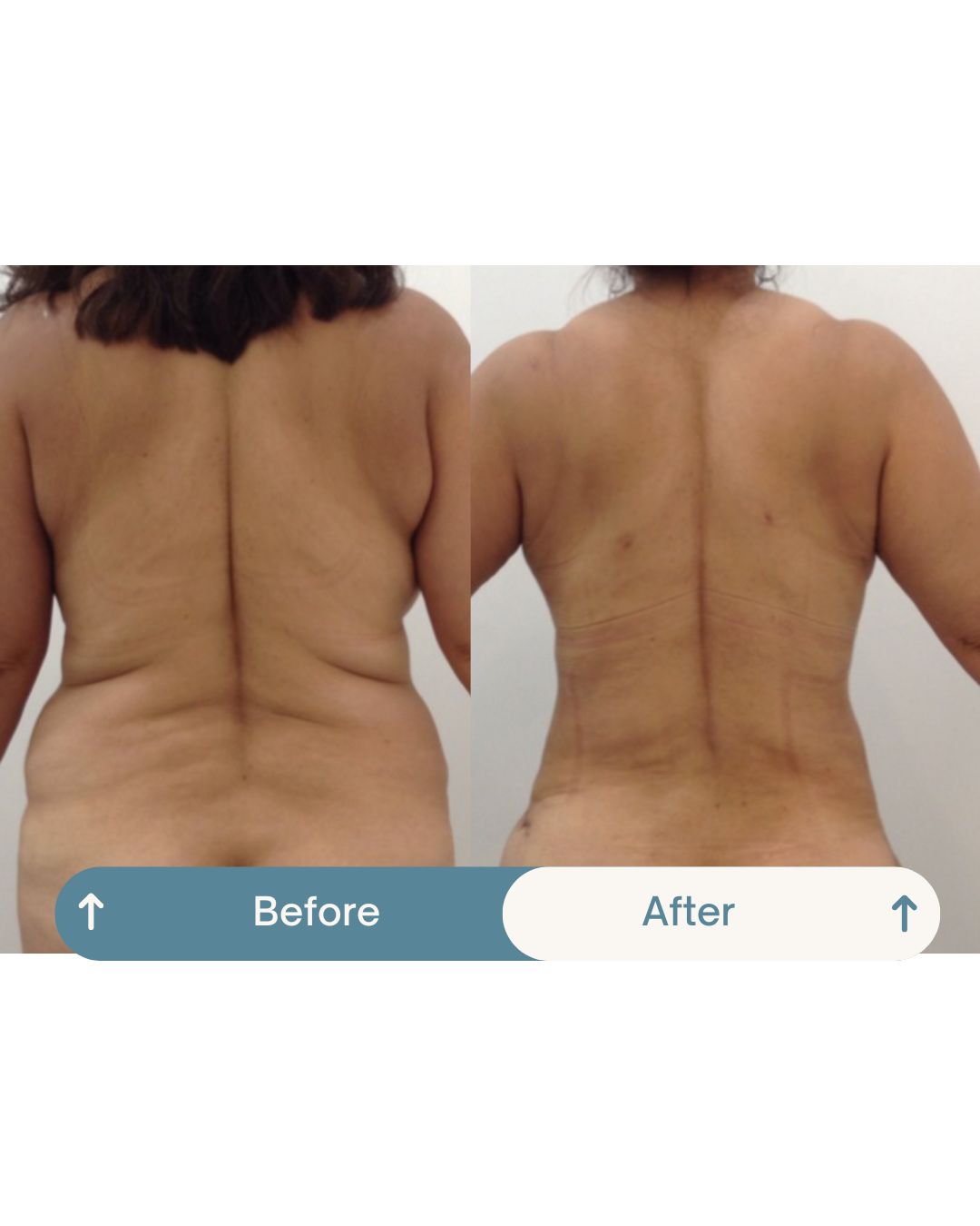 Nashielli Torres Espinosa Chiu-40