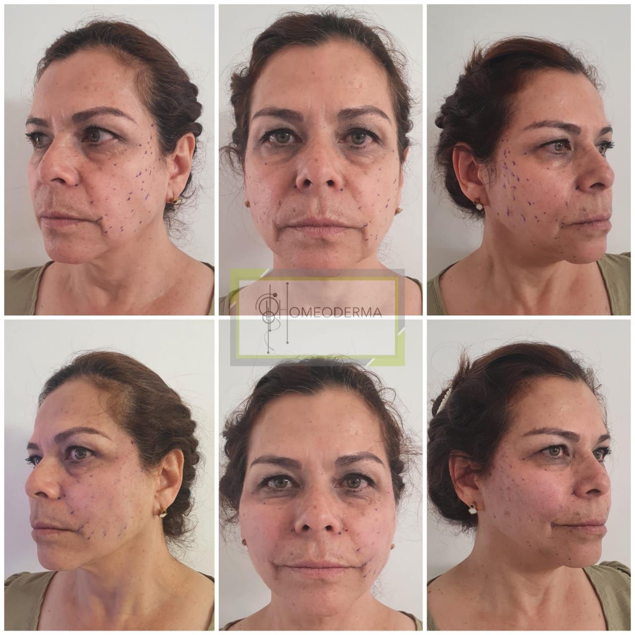 Gilliar Emmanuel Eudave De Lima-5