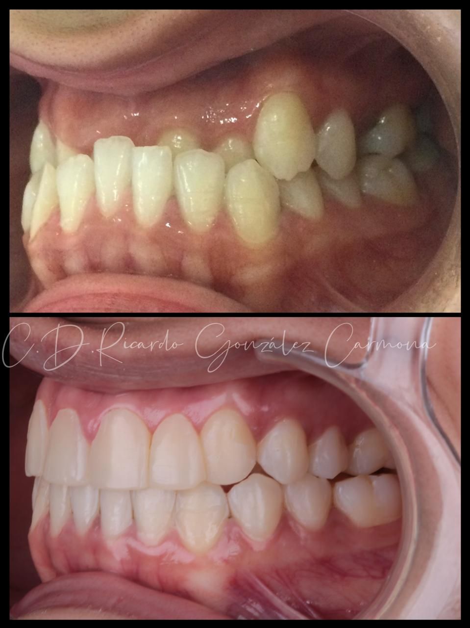 Alicia Carmona López-7