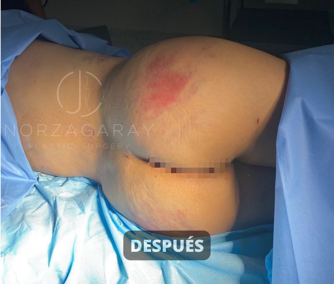 Juan Carlos Norzagaray-5