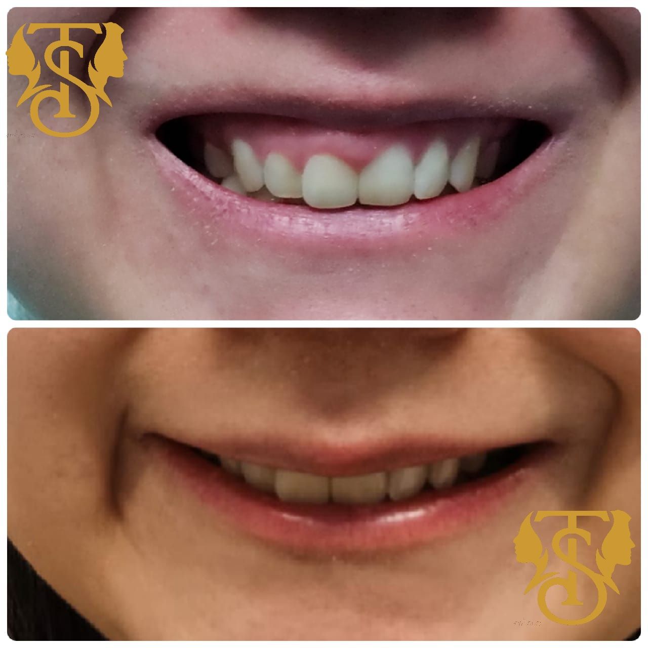 Samuel Torres Torres-7