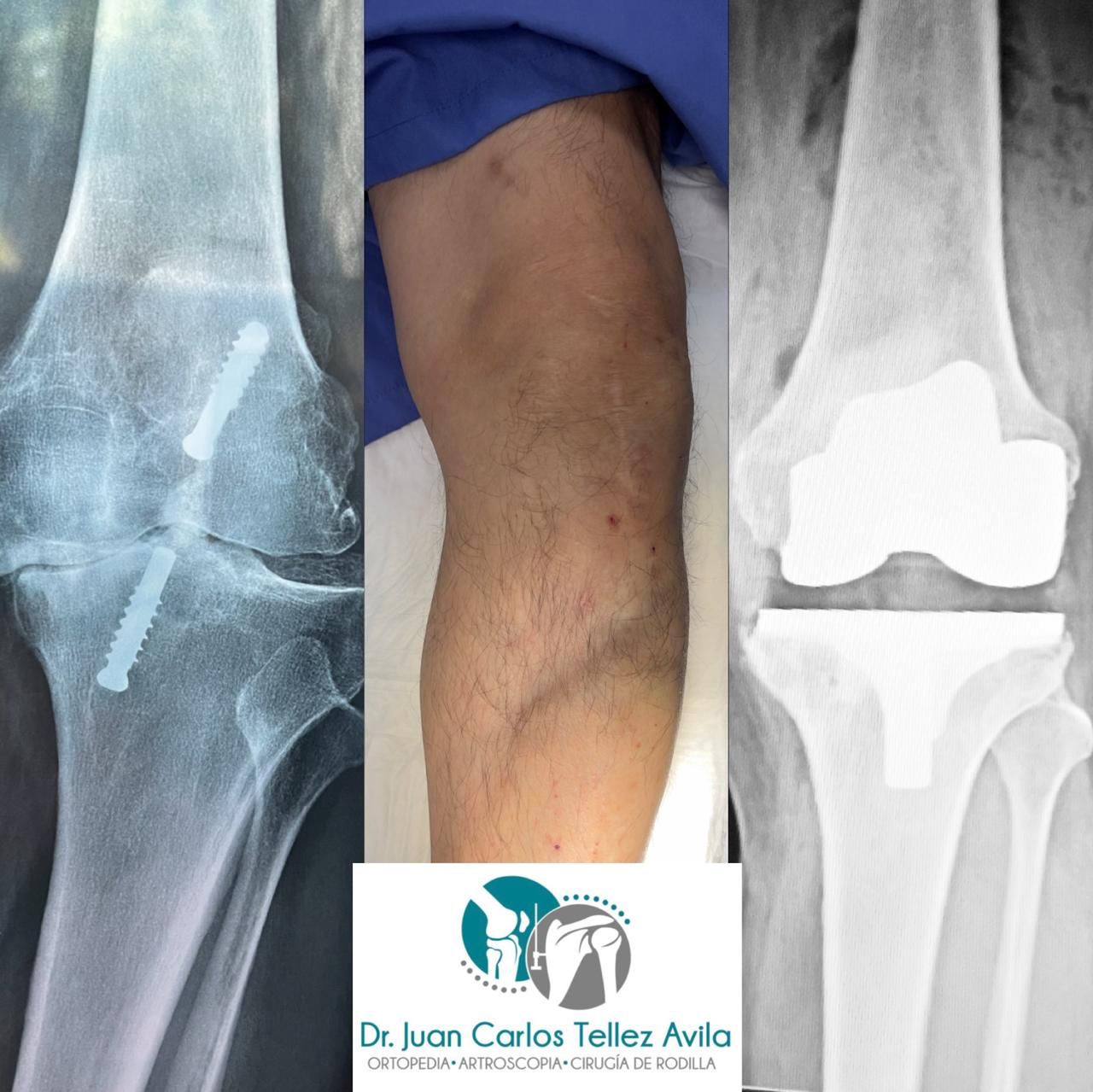 Juan Carlos Tellez Avila-10