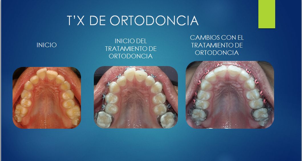 José Antonio Romero Lecanda-3